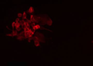 PPFIBP1 Antibody