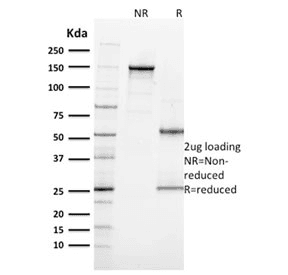 MKI67 / Ki67 Antibody (clone MKI67/2462)
