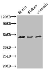 AGK Antibody