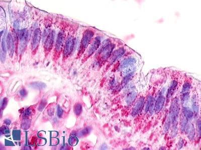 PathPlus™ Polyclonal Rabbit anti-Human GPR20 Antibody (C-Terminus, IHC)