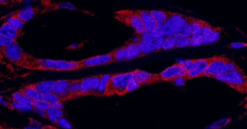 RPS6KA1 / RSK1 Antibody (aa375-425)