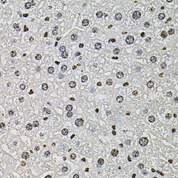 Polyclonal Rabbit anti-Human H2AFZ / H2A.z Antibody (IHC, WB)