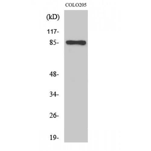 ADAP / FYB Antibody (620-700 aa, C-terminal)