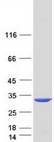 Human CCDC46 Protein (Recombinant Myc-DDK (Flag))