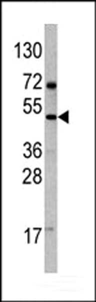 VEGFD Antibody (aa322-352)
