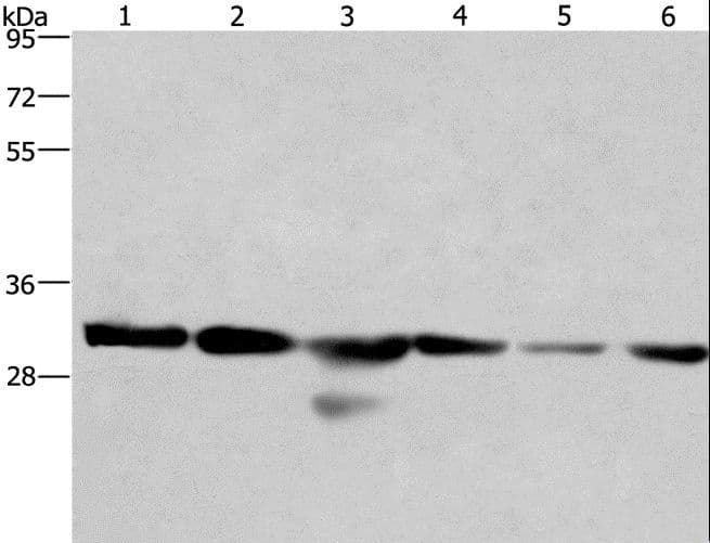 PHB / Prohibitin Antibody