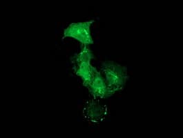 PDLIM2 / SLIM Antibody (clone OTI9A11)