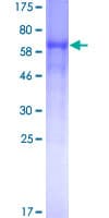 Human BACE1 / BACE Protein (Recombinant GST)