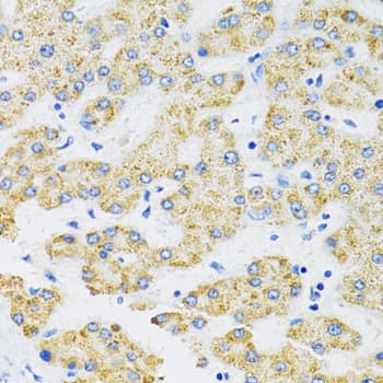 Polyclonal Rabbit anti-Human SLC16A4 Antibody (IHC, IF, WB)