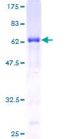 Human AIDA Protein (Recombinant GST)