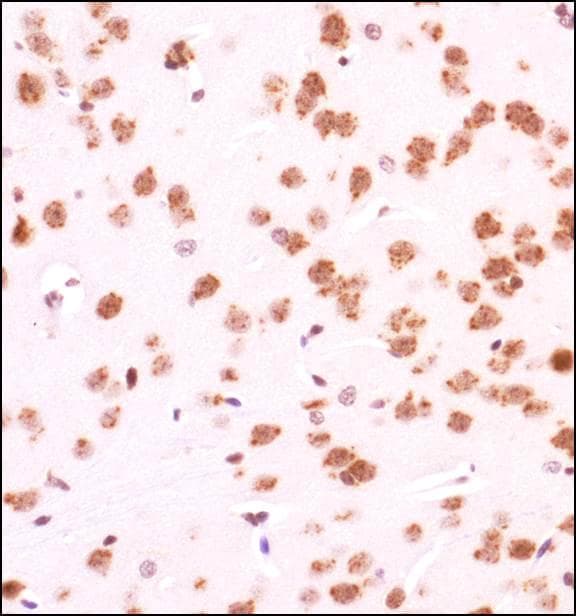 GLI / GLI1 Antibody