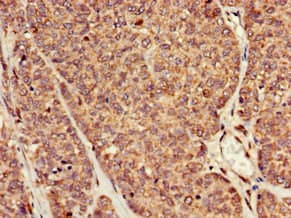 Polyclonal Rabbit anti-Human RAI1 Antibody (IHC, IF, WB)