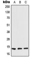RARRES2 / Chemerin Antibody (C-Terminus)