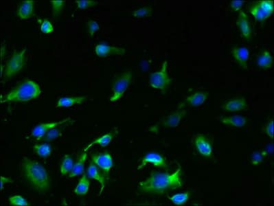 Polyclonal Rabbit anti-Human TMEM61 Antibody