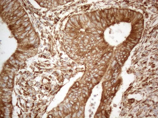 VAP33 / VAPA Antibody (aa2-227, clone OTI10E10, Carrier-free)