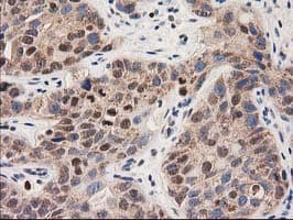 CLPP Antibody (clone OTI1E2, Carrier-free)