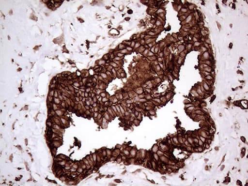 Monoclonal Mouse anti-Human IQGAP1 Antibody (clone OTI5F9, aa464-609, IHC, WB)