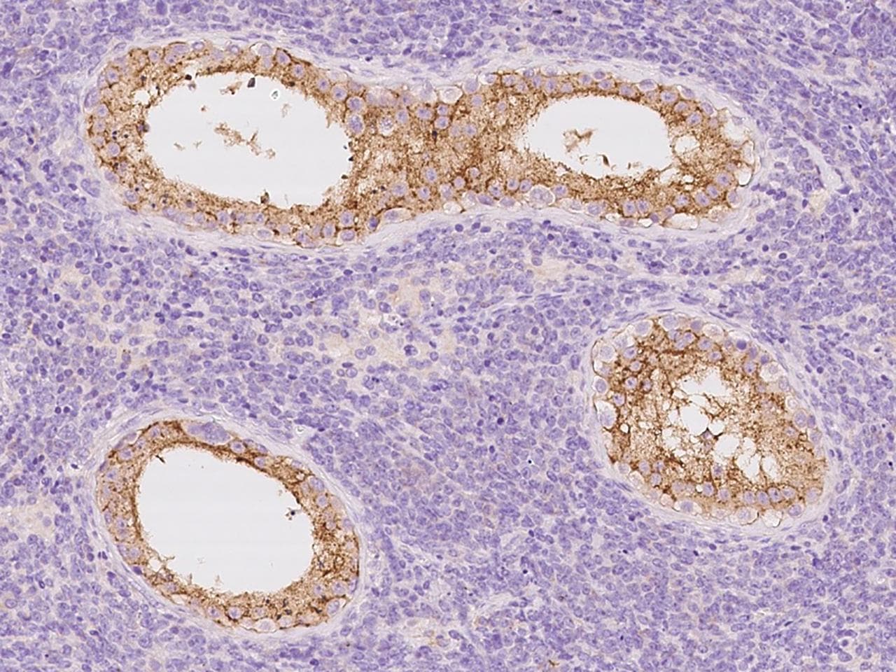 SLC30A3 / ZNT3 Antibody