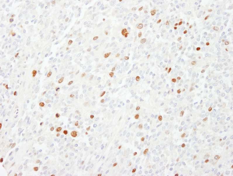 CENPF / CENP-F Antibody (aa2350-2400)