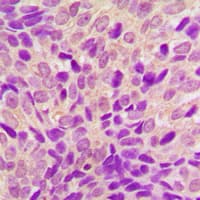 RPS6KA6 / RSK4 Antibody (C-Terminus)