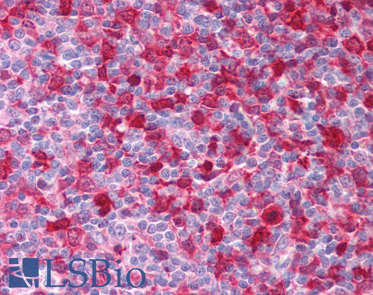 IHC-plus™ Monoclonal Mouse anti-Human SYK Antibody (clone SYK-01, aa5-360, IHC, WB)