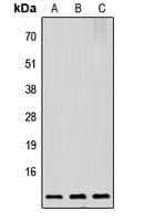 PTMA / Prothymosin Alpha Antibody (C-Terminus)