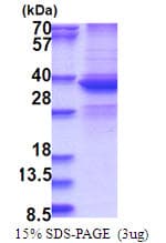Human DDX39 Protein (Recombinant His)