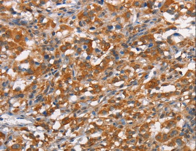 HMMR / CD168 / RHAMM Antibody
