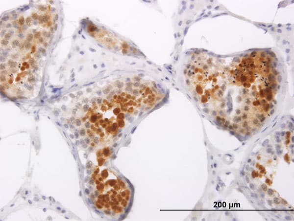 IPP2 / PPP1R2 Antibody (clone 2G11)