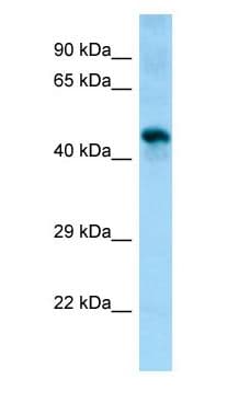 Polyclonal Rabbit anti-Mouse SGMS1 / TMEM23 Antibody (aa154-203, WB)