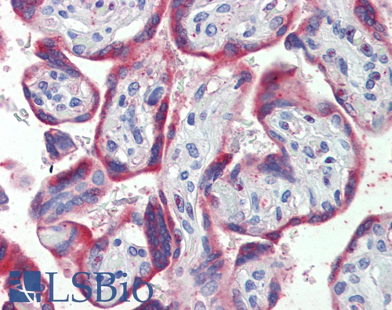 IHC-plus™ PDGF-BB Antibody (aa222-233)