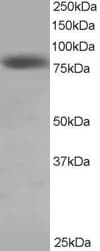 IHC-plus™ HEC1 / NDC80 Antibody (aa630-642)