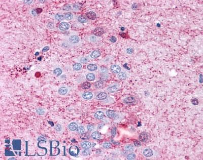PathPlus™ GPR108 Antibody (Cytoplasmic Domain)
