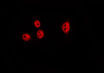 HDAC4 Antibody