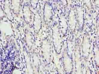 FAM3B Antibody
