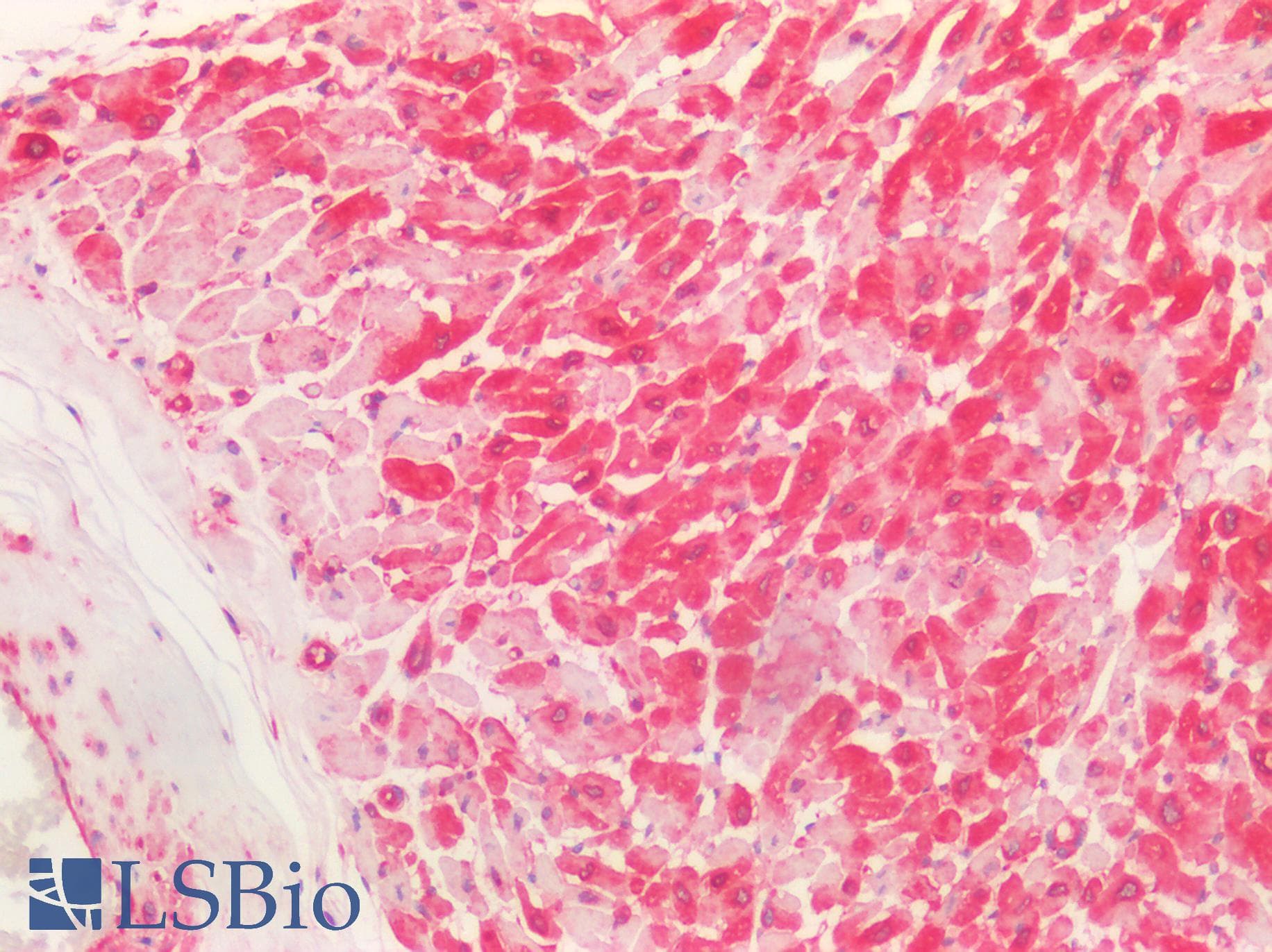 IHC-plus™ Polyclonal Rabbit anti-Human HTR2C / 5-HT2C Receptor Antibody (aa400-450, IHC, IF, WB)