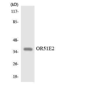 Polyclonal Rabbit anti-Human OR51E2 / PSGR Antibody (aa188-237, WB)