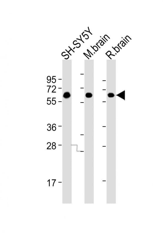 DPYSL5 / CRMP5 Antibody (clone 1503CT789.209.250.52)