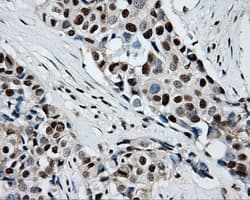 RPA2 / RFA2 / RPA34 Antibody (clone OTI9A1)