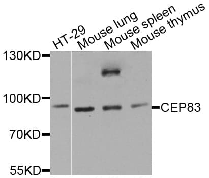 Polyclonal Rabbit anti-Human CEP83 / CCDC41 Antibody (WB)