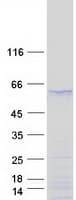 Human SOX17 Protein (Recombinant Myc-DDK (Flag))