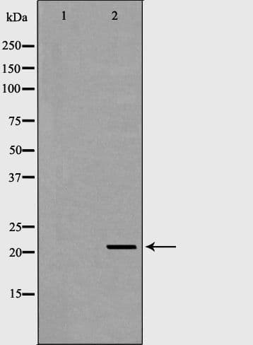 Polyclonal Rabbit anti-Human RAC2 Antibody (IHC, WB)