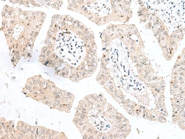 NGEF / EPHEXIN Antibody