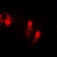 CSTB / Cystatin B / Stefin B Antibody (Internal)