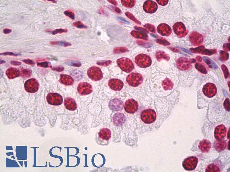 IHC-plus™ Histone H3 Antibody (Acetyl-Lys9)