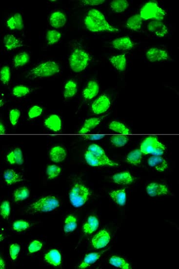 IHC-plus™ LIG3 / DNA Ligase III Antibody