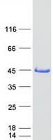 Human SMS / Spermine Synthase Protein (Recombinant Myc-DDK (Flag))
