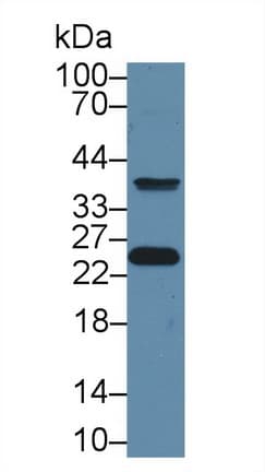 GSTP1 / GST Pi Antibody (aa1-210, APC)