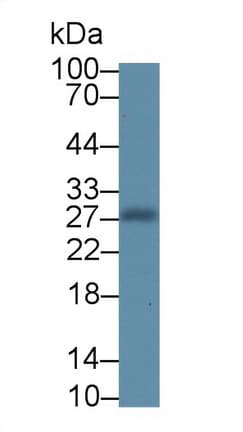 NOG / Noggin Antibody