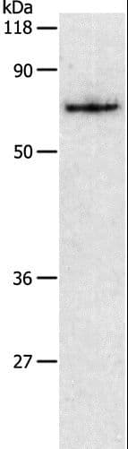 Polyclonal Rabbit anti-Human PKM / Pyruvate Kinase, Muscle Antibody (IHC, WB)